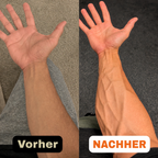 Vorher-nachher-Vergleich des Unterarms
